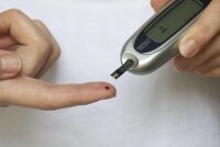 Могли ли вы быть диабетиком? 5 признаков диабета у женщин, которые остаются незамеченными.